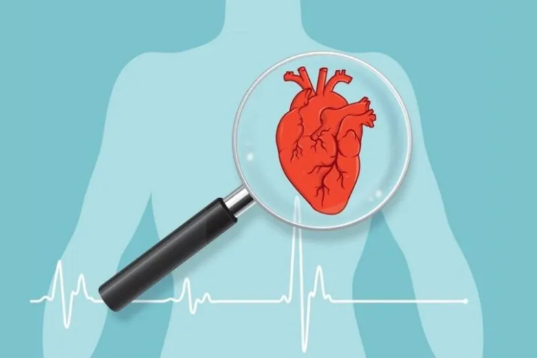 ecg-la-gi-1